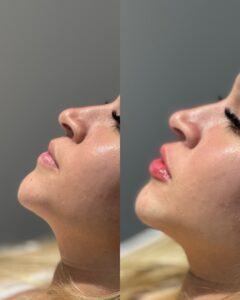 dr.paulopinheiro_421569363_17999384531415659_1348842059214246741_n