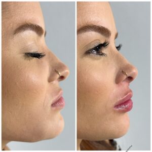 dr.paulopinheiro_432913758_18004527920415659_1716617771041872709_n