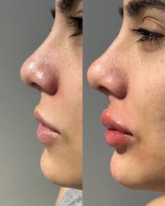 dr.paulopinheiro_451678068_18016913018415659_7792021654961062147_n