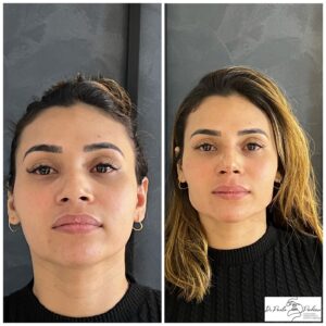 dr.paulopinheiro_452589647_18017742809415659_3014769055166468670_n