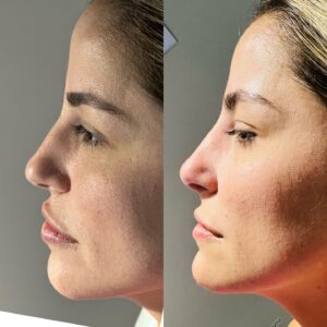 dr.paulopinheiro_453412864_18018345329415659_3120387398784750273_n