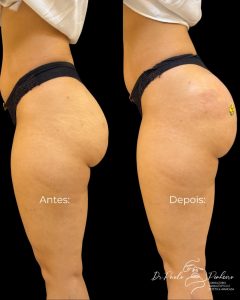 SaveClip.App_580521784_18066073718415659_7307454507832650582_n