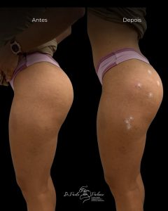 SaveClip.App_610621819_18071721851415659_6556594447021725556_n